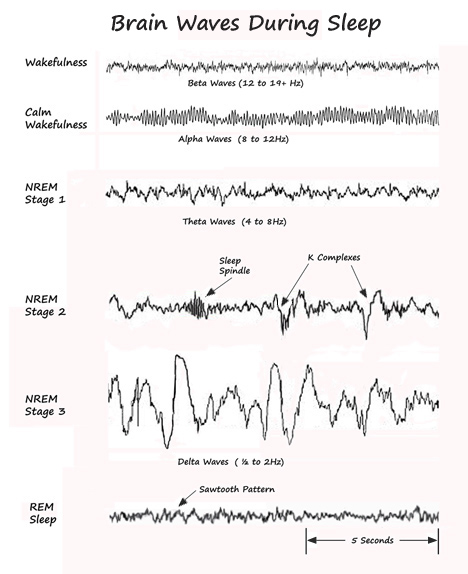 Brain Waves of Sleep