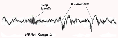 Stage 2: Sleep Spindles and K Complexes